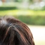 how to stop Premature Hair Growth